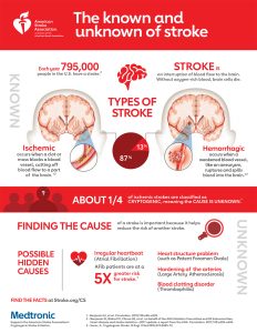 Stroke recovery for home care