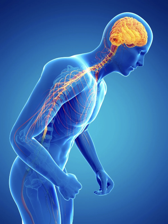 Parkinson's Progression