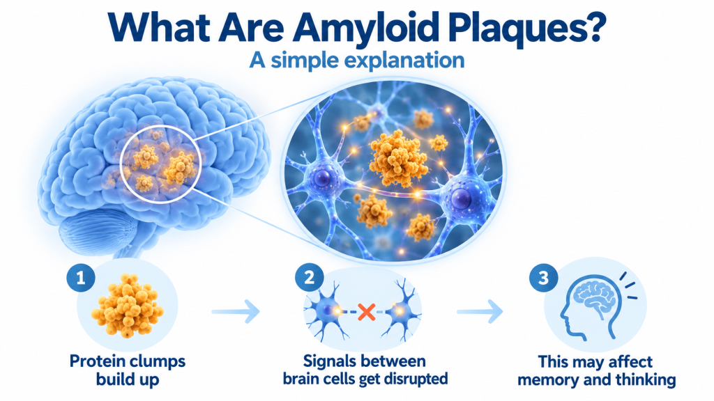 Amyloid Plaques Explained