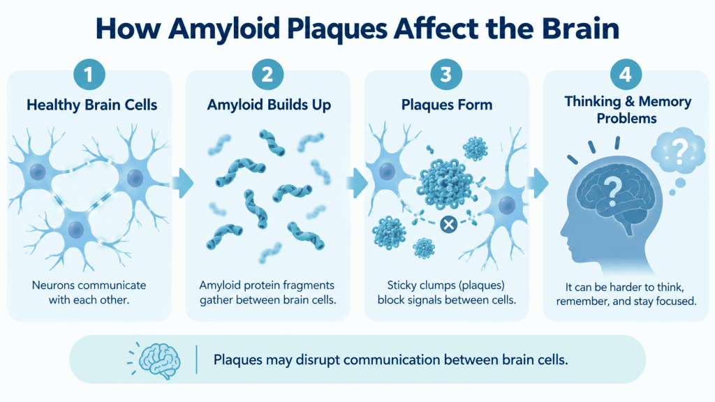 How Amyloid Plaques Affect the Brain