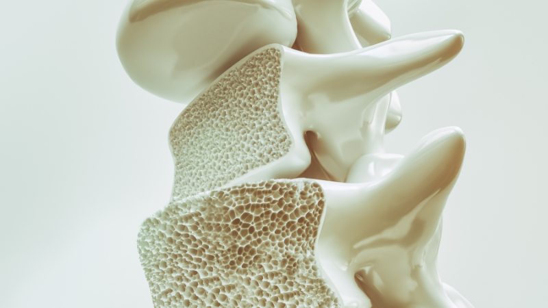 Osteoporosis - Assisting Hands Home Care 