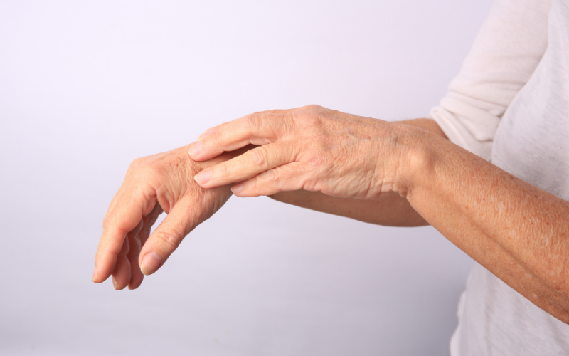 Medications and Health Conditions That Cause Bruising