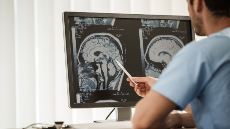 Rear view of doctor reviewing MRI scans of a patient with brain tumor
